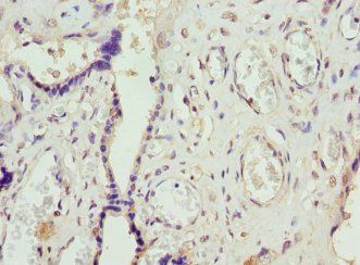 IgG R FcRn large subunit p51 antibody