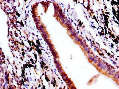 FCGRT Antibody
