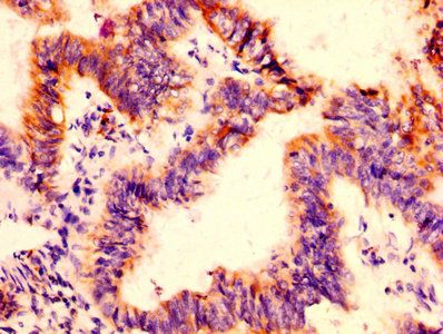 FCGRT Antibody