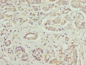 IgG R FcRn large subunit p51 antibody