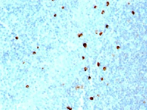 IgM (Immunoglobulin Mu Heavy Chain) (B-Cell Marker) Antibody