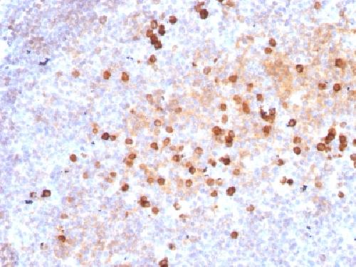 IgM (Immunoglobulin Mu Heavy Chain) (B-Cell Marker) Antibody