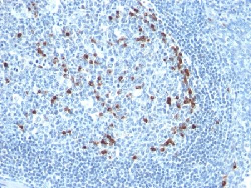 IGKV1D-16 Antibody