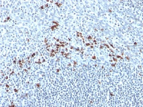 IGKV1D-16 Antibody