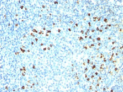 IGLV1-51 Antibody