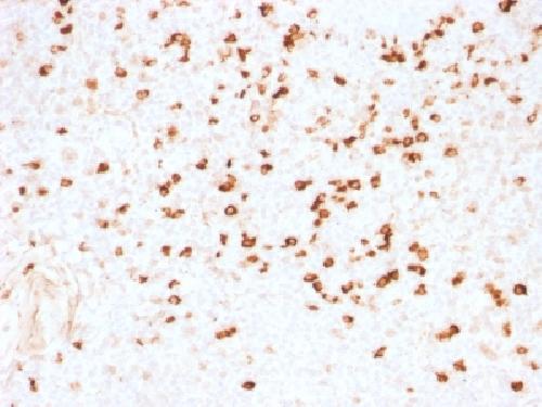 IGLV1-51 Antibody