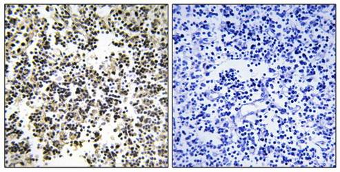 IGLL1 antibody