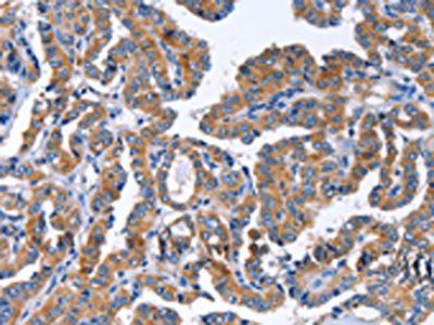 IGSF10 Antibody