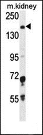 IGSF1 antibody