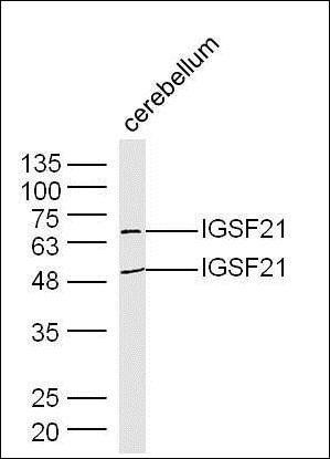IGSF21 antibody