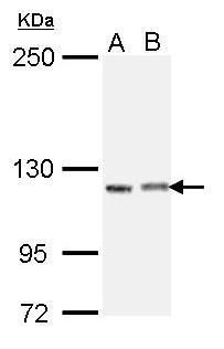 Scinderinderin antibody