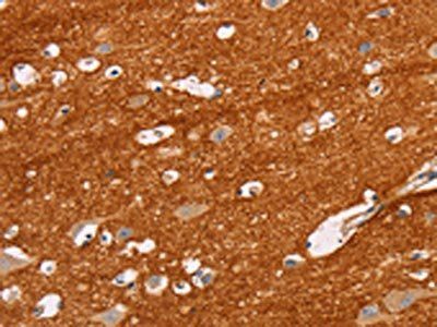 IGSF8 Antibody