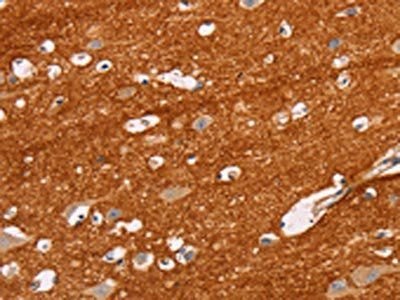 IGSF8 antibody