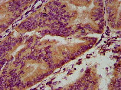 IGSF9 Antibody