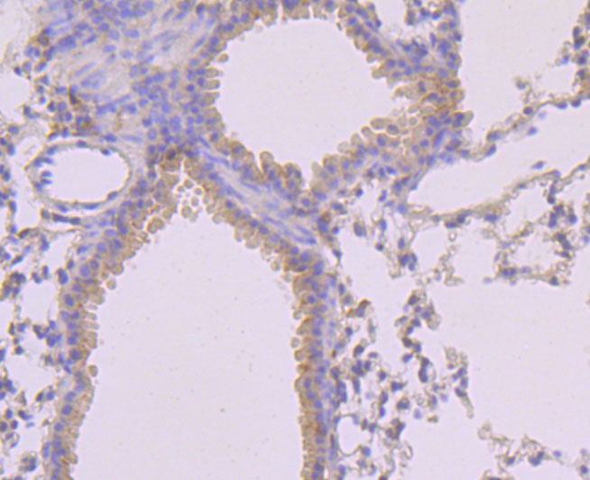 MLKL (Phospho-S345) Antibody