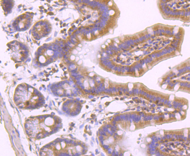 MLKL (Phospho-S345) Antibody
