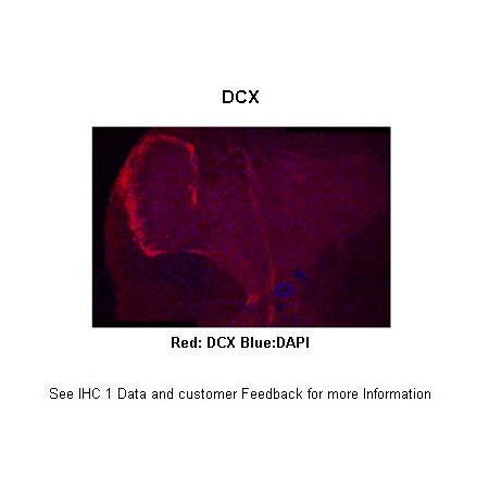 Doublecortin antibody