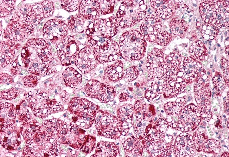 Goat anti-ETFA (aa139-152) Antibody