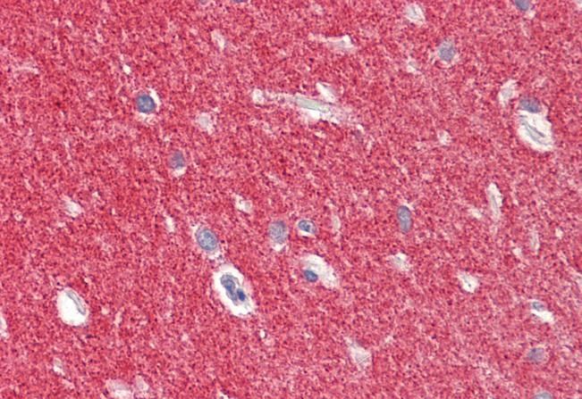 Goat anti-Alpha-synuclein Antibody