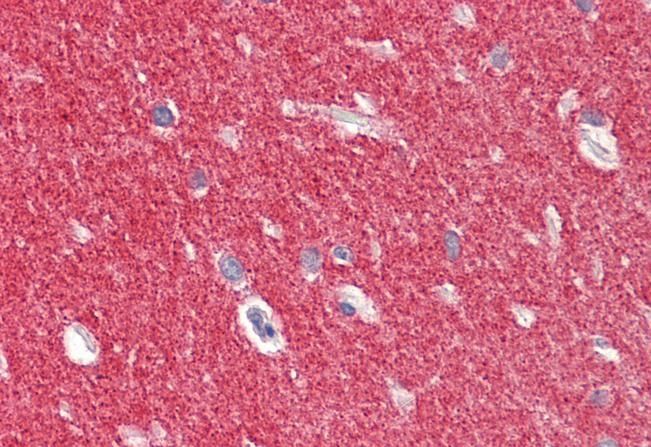 SNCA antibody