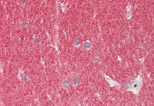 Goat anti-Alpha-synuclein (NACP140) Antibody
