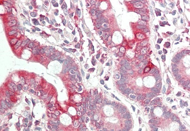 VEGFA (aa288-299) Antibody