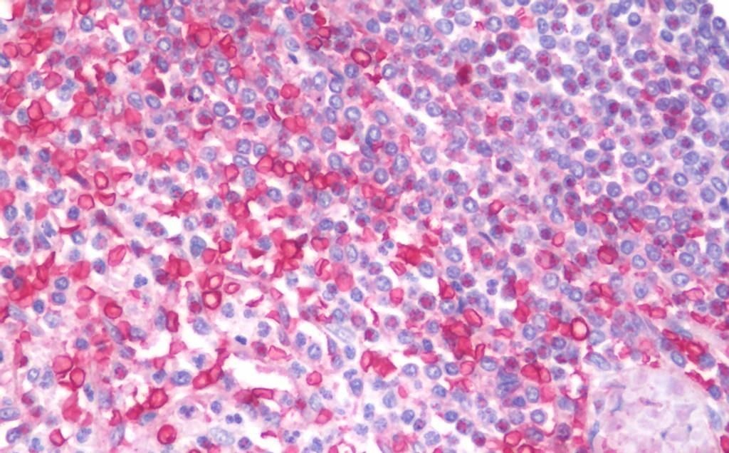 Goat anti-MIA / CD-RAP Antibody