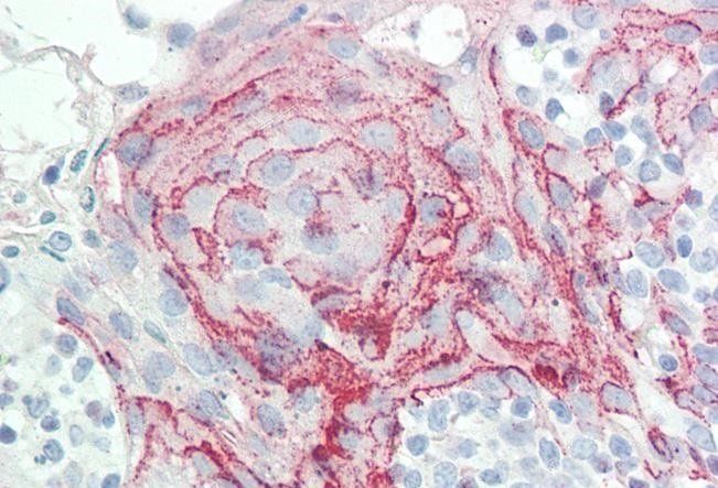 Goat anti-HOXC6 (isoform 1) Antibody
