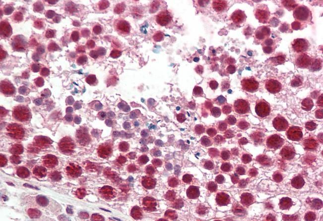 Goat anti-HNRNPA2B1 Antibody