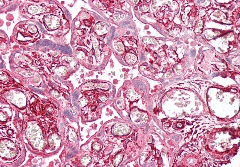 Goat anti-tropomyosin 4 / TPM4 Antibody