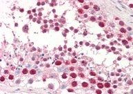 Goat anti-dUTPase / DUT Antibody