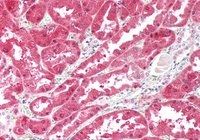 Goat anti-Ketohexokinase Antibody