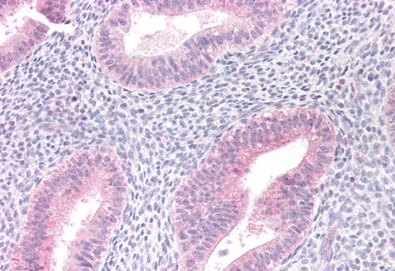 Goat anti-MTM1 Antibody