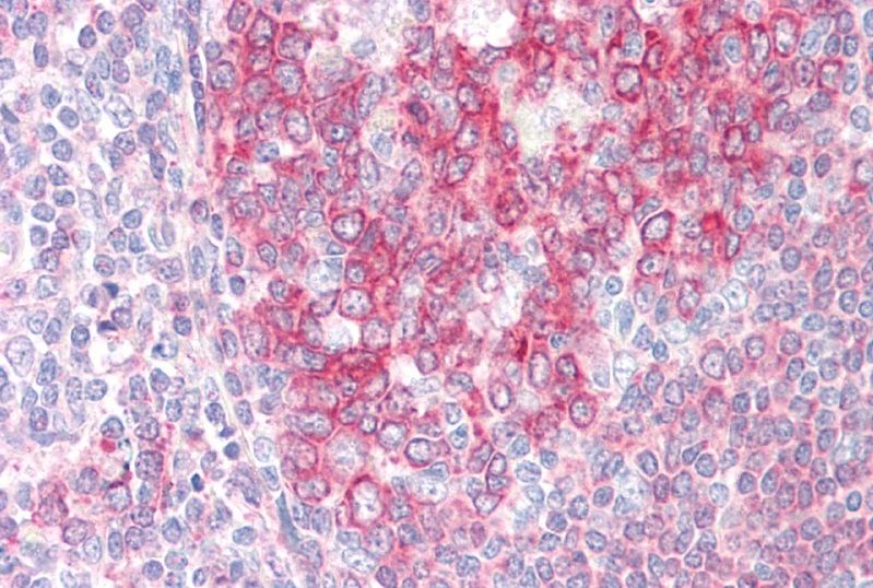 Goat anti-SWAP70 Antibody
