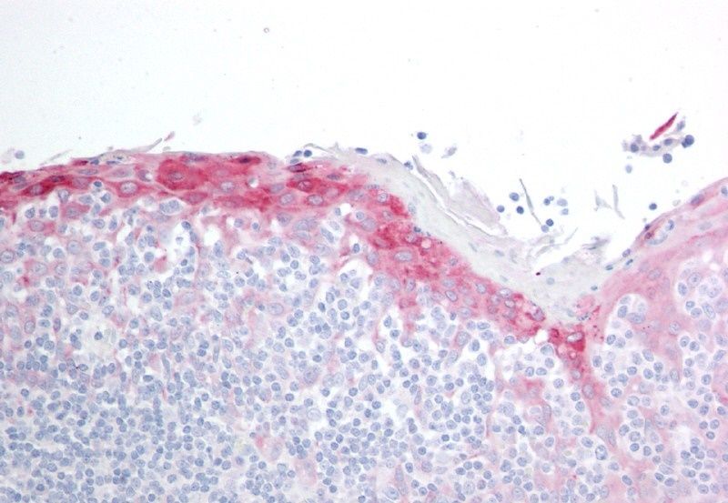 Goat anti-H11 / HSP22 Antibody