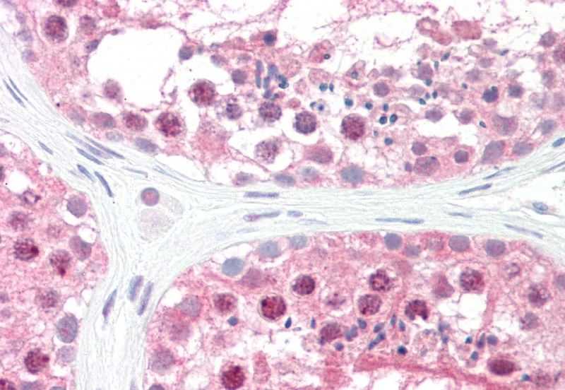Goat anti-GPS1 / COPS1 Antibody