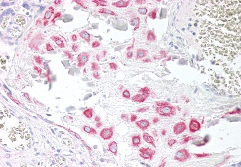Goat anti-VPS45 (C Terminus) Antibody