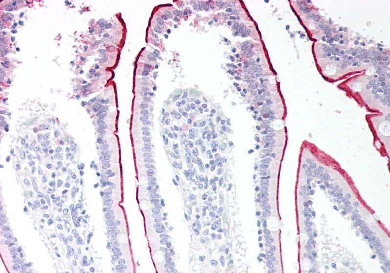 Goat anti-VPS45 (C Terminus) Antibody