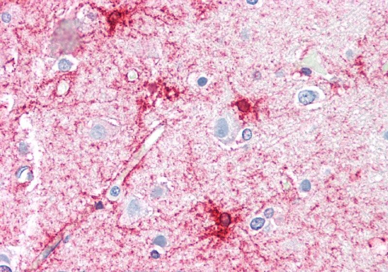 Goat anti-VPS45 (C Terminus) Antibody