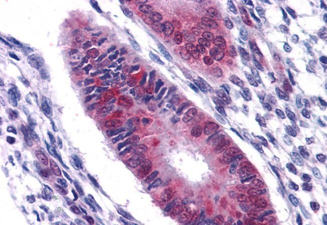 Goat anti-DDX5 / p68 RNA helicase Antibody