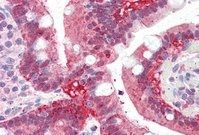 Goat anti-AKR1C3 Antibody