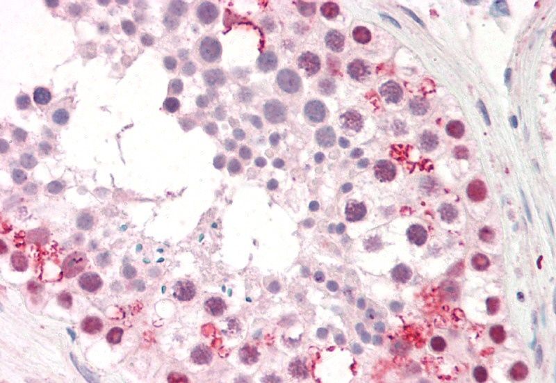 PUM2 Antibody