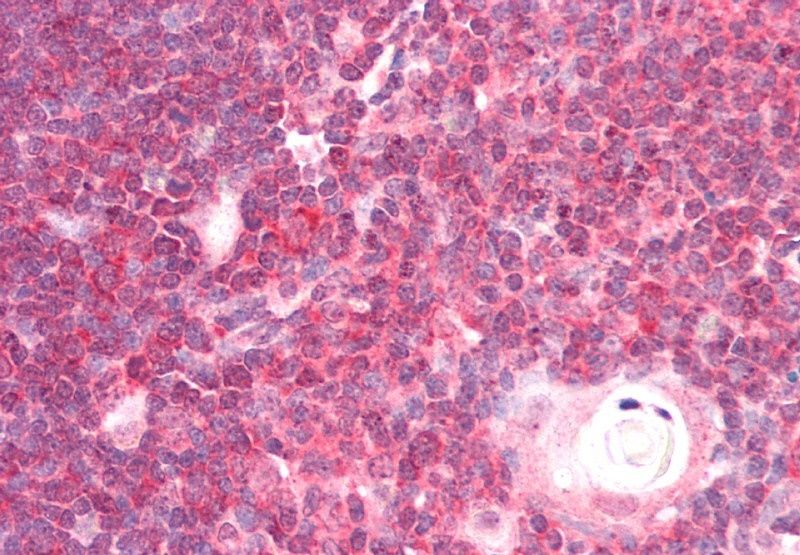 Goat anti-DEAD-box protein 6 Antibody