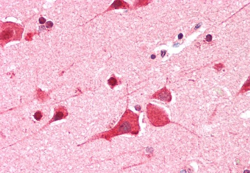 Goat anti-DEAD-box protein 6 Antibody
