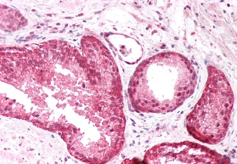 Goat anti-PICK1 Antibody