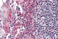 Goat anti-CSNK1E Antibody