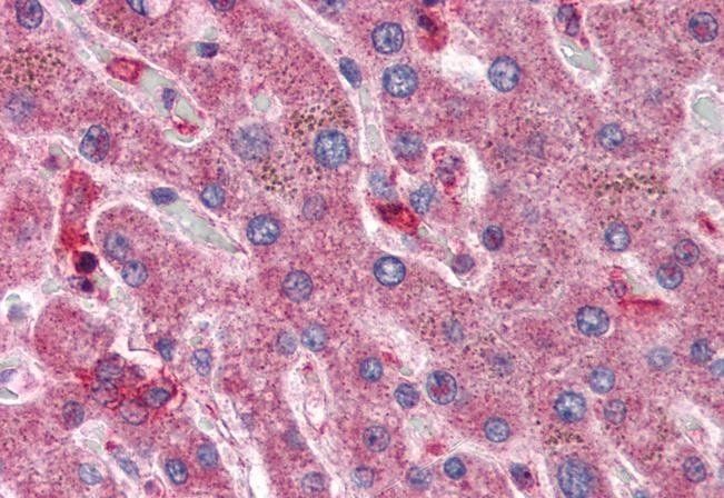 Goat anti-Hyaluronidase 1 Antibody