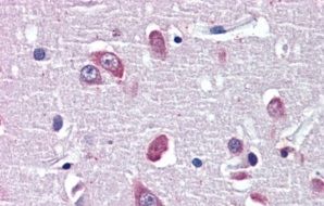 Goat anti-BDNF Antibody