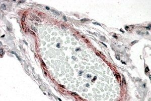 Goat anti-CRP2 / CSRP2 Antibody