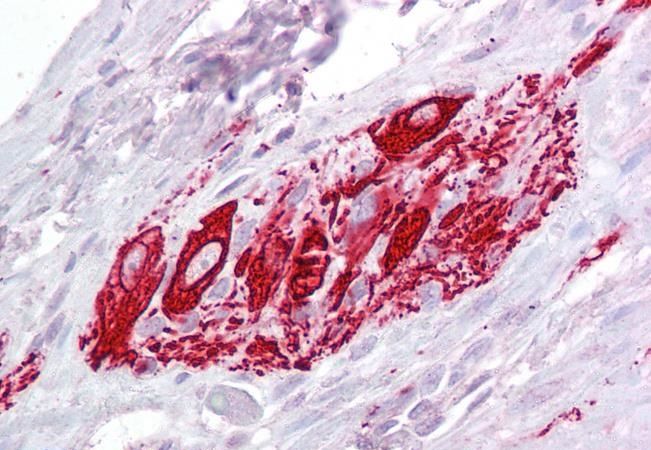 Goat anti-ITM2B Antibody